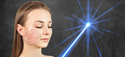 headerfoto_laser.png